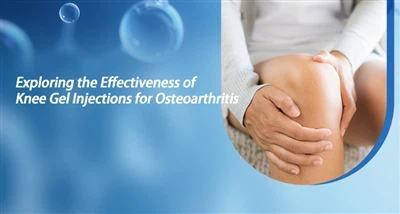 Explorer l'efficacité des injections de gel pour le genou pour l'arthrose